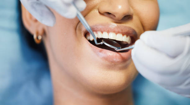 Best Broken or Chipped Tooth Repair in Thayer, MO