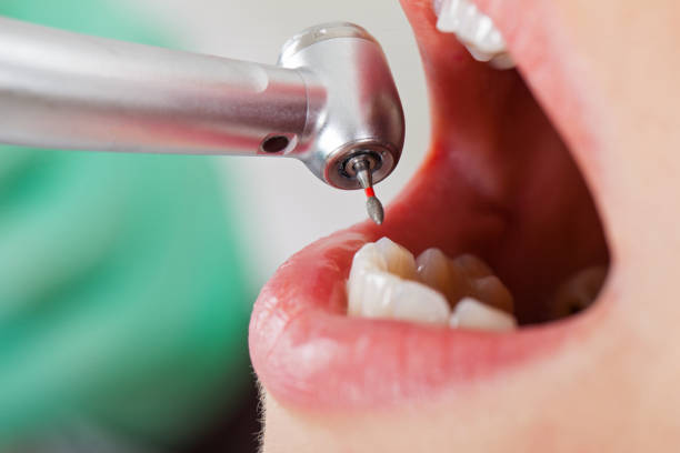 Best Lost Filling or Crown Replacement in Thayer, MO
